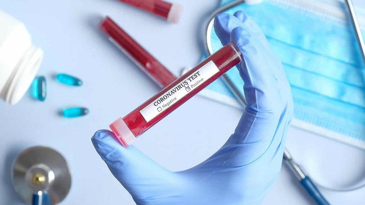 صفر تا صد تست کرونا در آزمایشگاه‌ها؛ از نمونه برداری تا هزینه تشخیص کووید ۱۹
